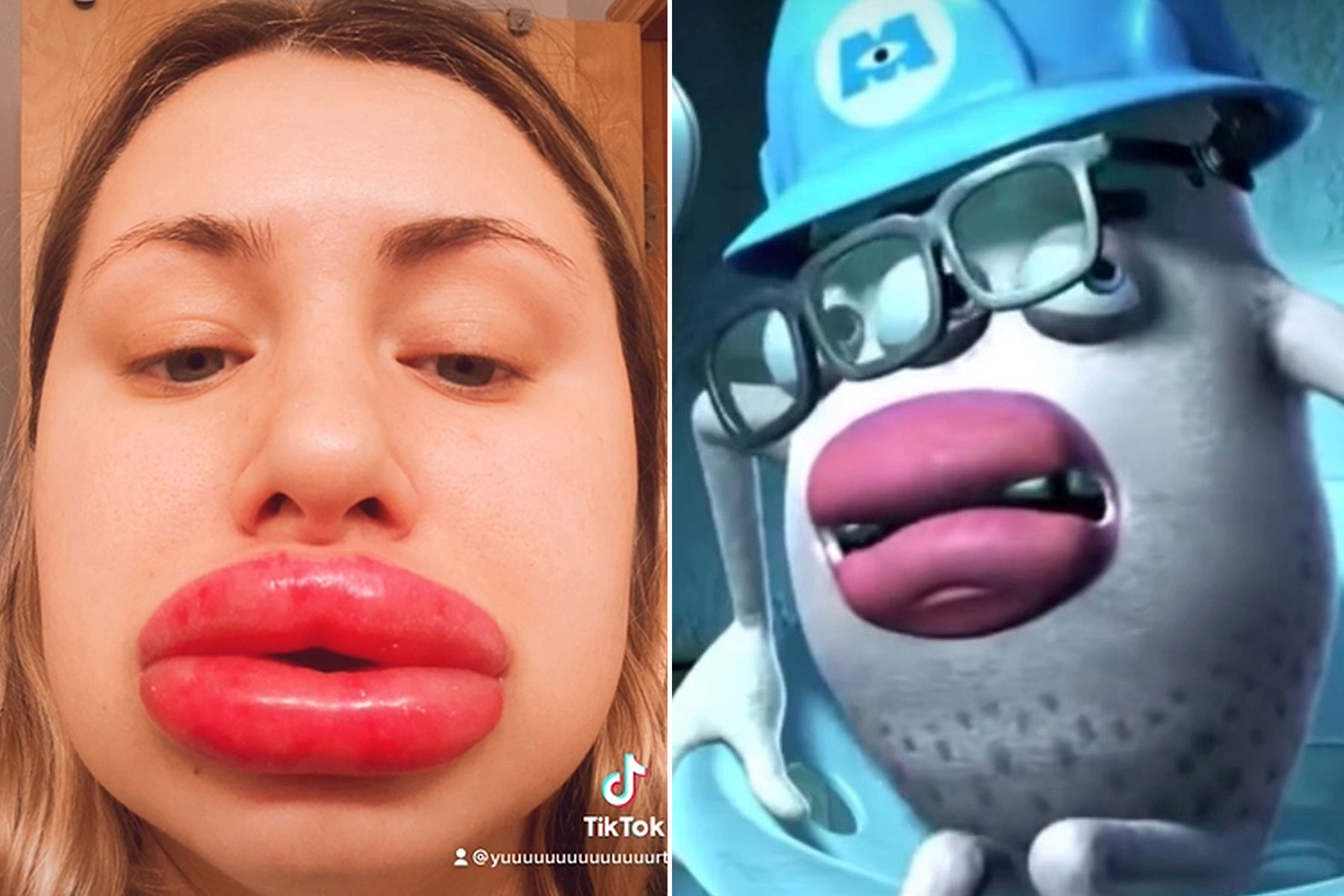 ava driscoll recommends fake lips porn pic