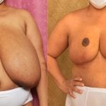 caitlin siejka recommends floppy huge tits pic