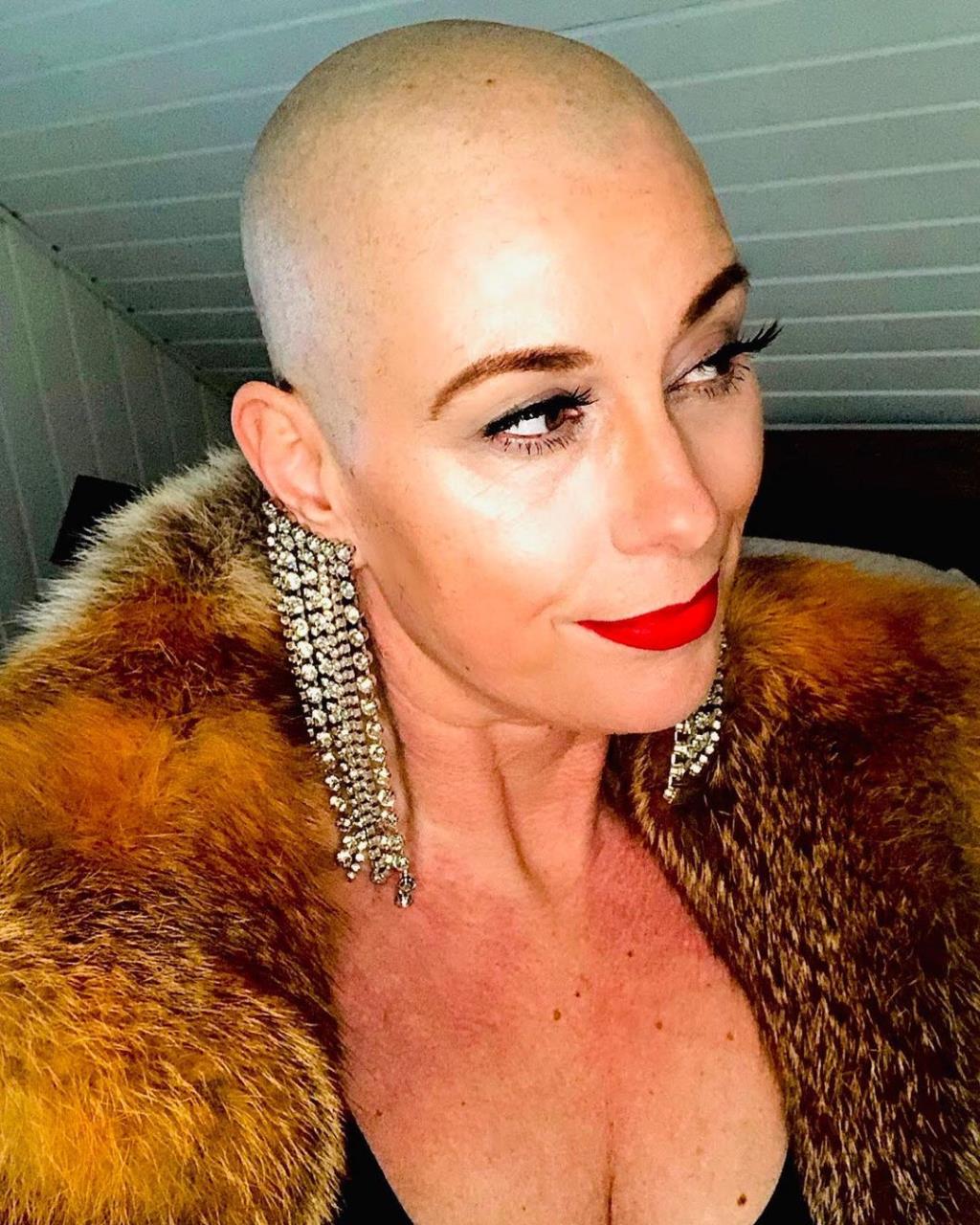 milf bald