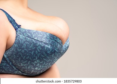 anthony milner recommends big tit small bra pic