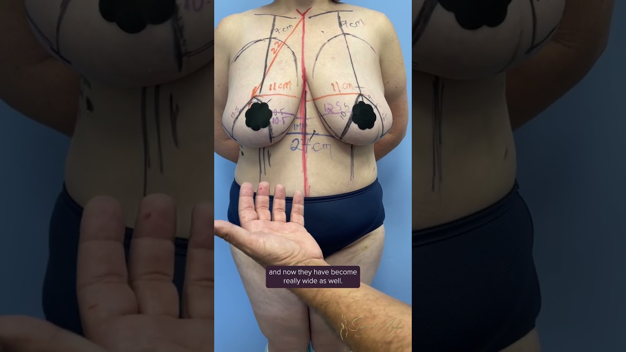 amy blankenship recommends breast suspension videos pic