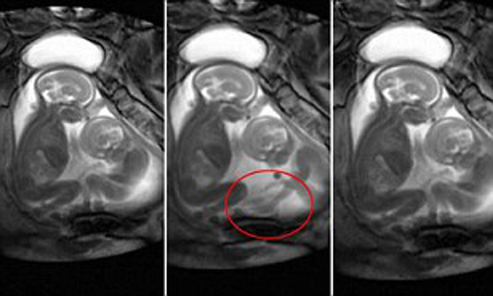 ben littlejohns recommends twins eat each other out pic