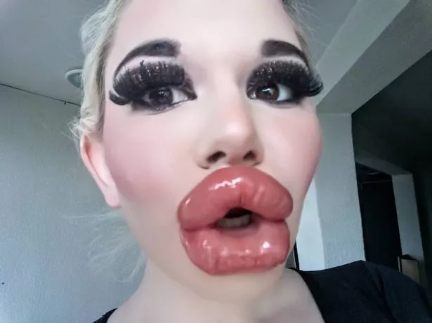 aesha vora add fake lips porn photo