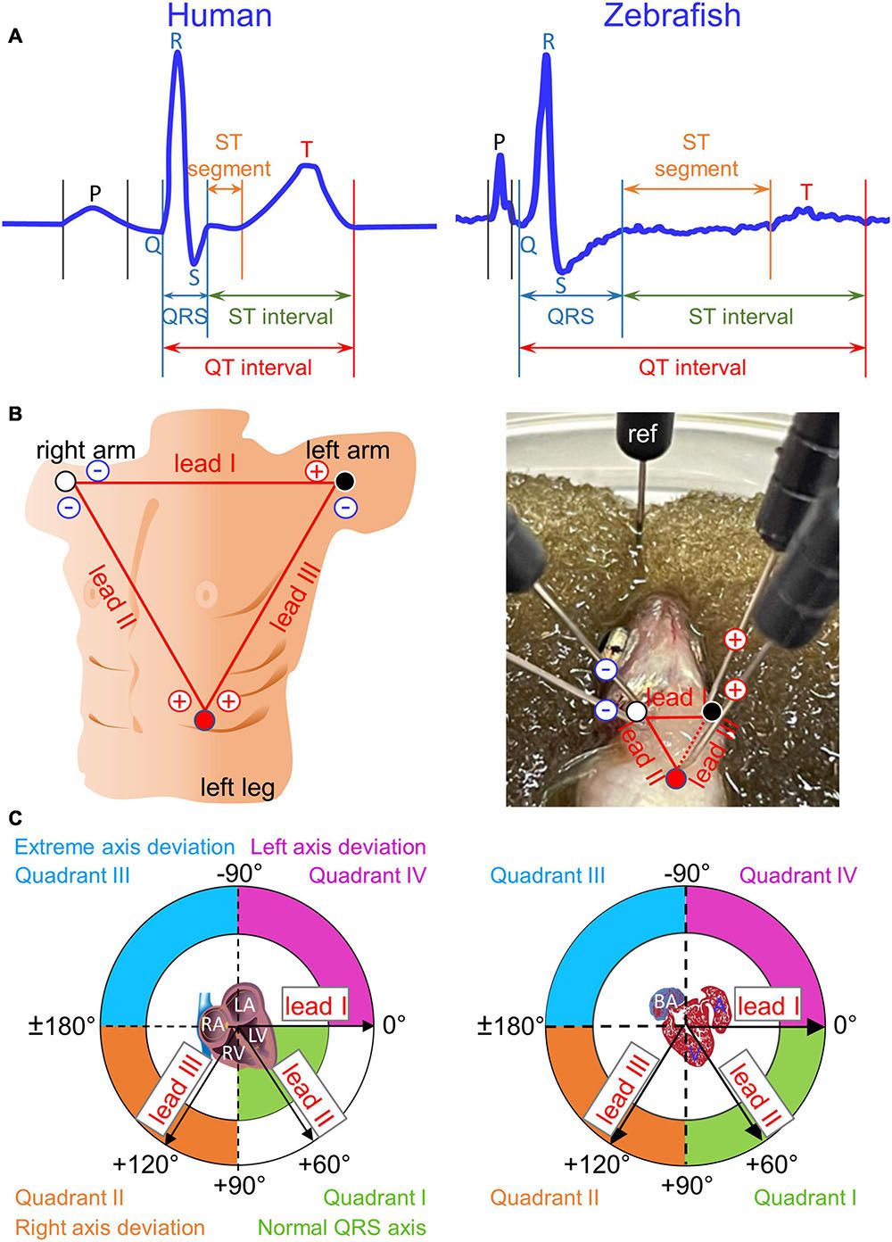 asmani asma add photo ecg first anal