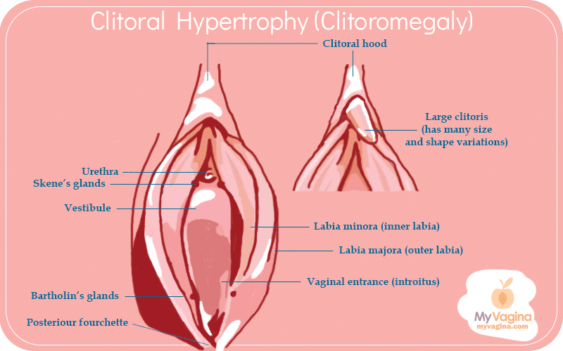 diane emmerson recommends biggest clitoris pic