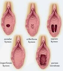 cobus nieuwoudt recommends breaking hymen with finger pic