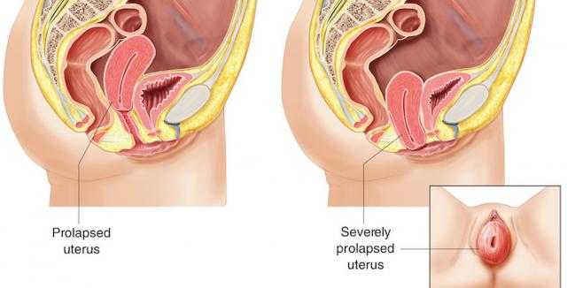 avelino manalo recommends Uterus Porn